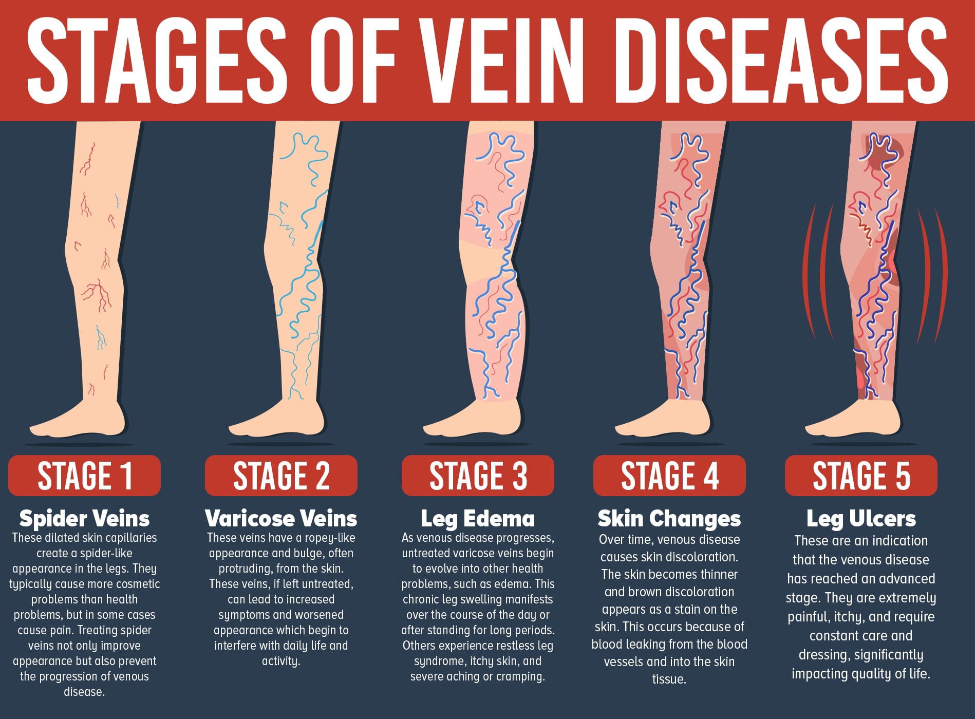 stages of ulcers