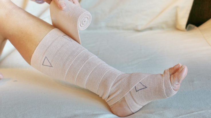 What You Need to Know About Leg Ulcers and Treatments