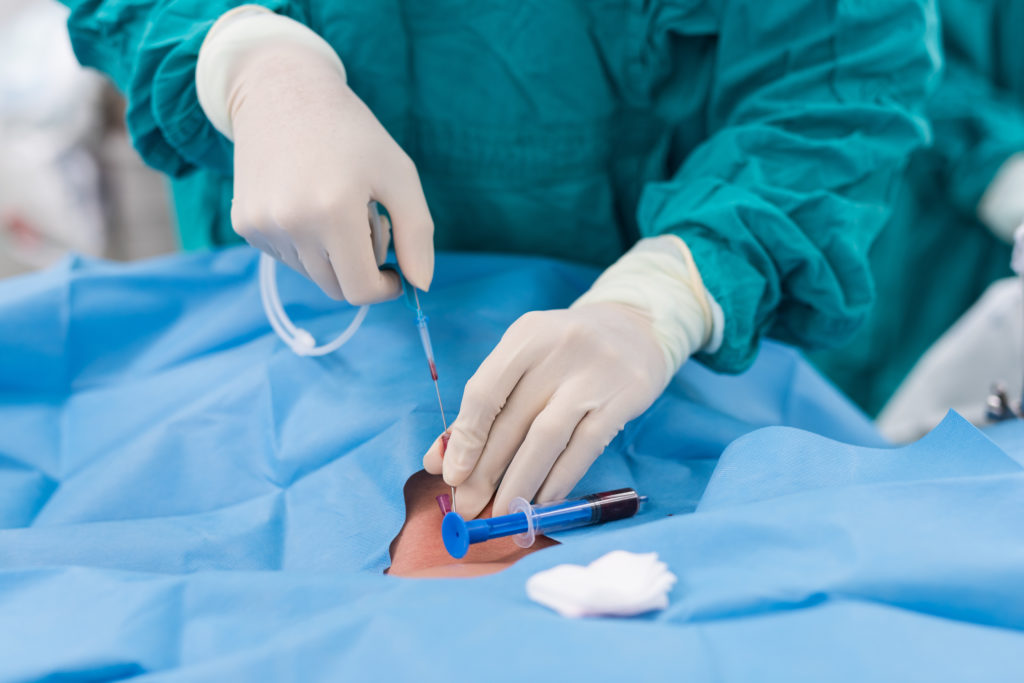 a surgeon performing venous surgery