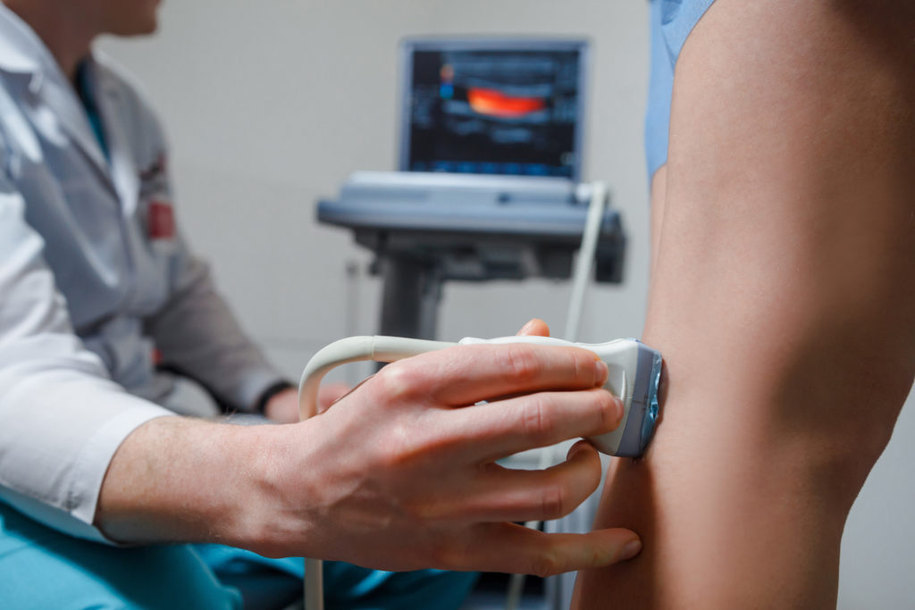 doctor doing ultrasound examination of patient's leg veins in his office. Young woman passing ultrasound scan in clinic. Doctor work. Medical research.