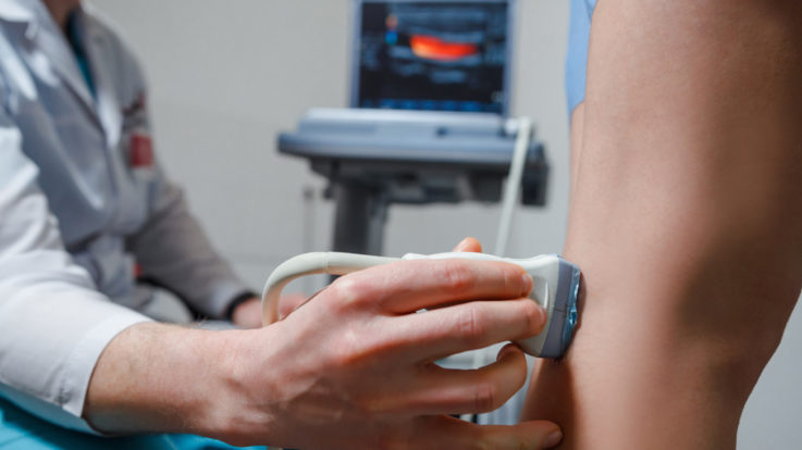 Venous Ultrasound: The Amazing Inspiration and How the Technology is Used for Treatment of Varicose Veins