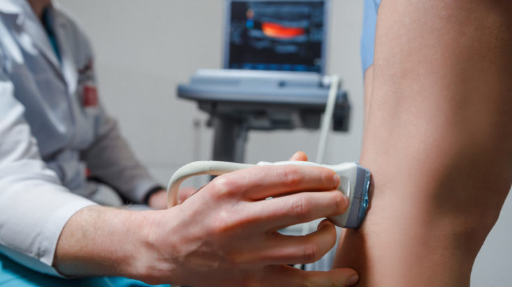 Venous Ultrasound: The Amazing Inspiration and How the Technology is Used for Treatment of Varicose Veins